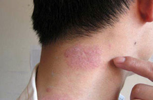 ţƤѢ�γɵ�ԭ�����Ŵ�����Ⱦ�����߹����ϰ��й���