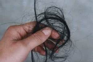 ÿ��ͷ������������ʲôԭ�򣿸���ô���ƣ�