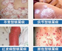 ��������ţƤѢ��Ҫ����Ǯ