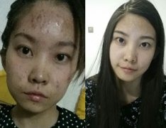 ��������Ƥ��Ҫ����Ǯ��