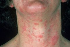 õ�忷����ʲôԭ������ģ�